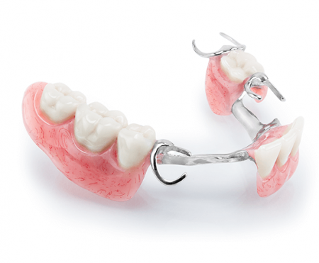 Cast Partial Dentures | Afdent Patient Friendly Dentistry