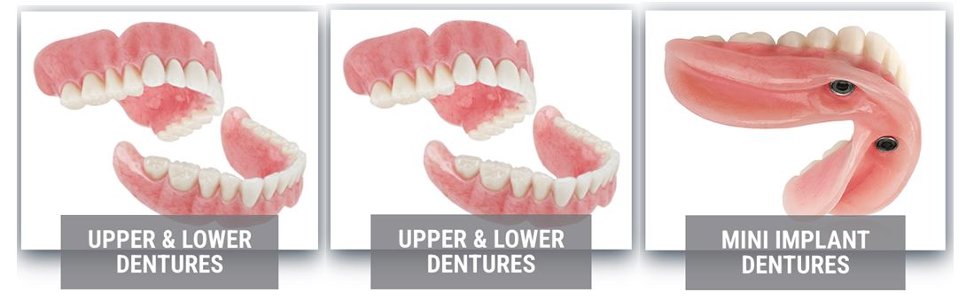 type of dentures